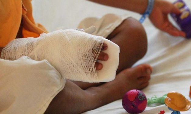 En celebración de Año Nuevo, 2 adolescentes quemados con pólvora en Barranquilla