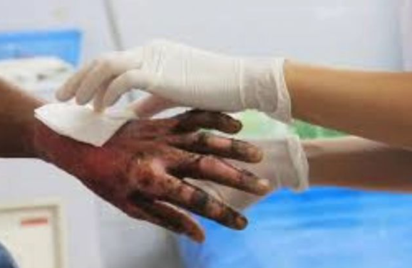 En Noche de Velitas, 17 quemados en el Atlántico: tres en Barranquilla
