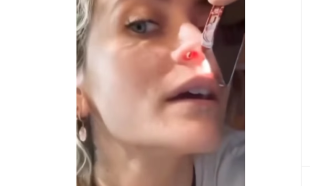 Paris Jackson revela el daño que las drogas causaron en su nariz: “Me arruinaron la vida”